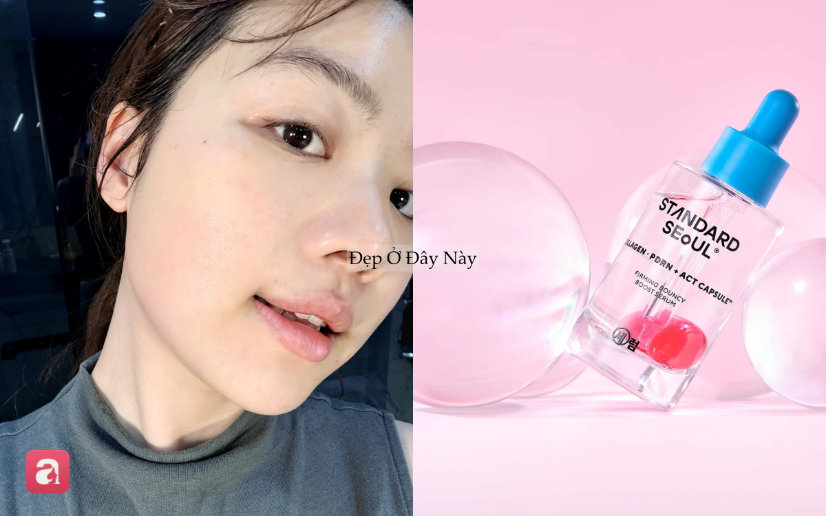 5 Th&agrave;nh phần chống l&atilde;o h&oacute;a thay thế retinol an to&agrave;n cho da nhạy cảm năm 20265 