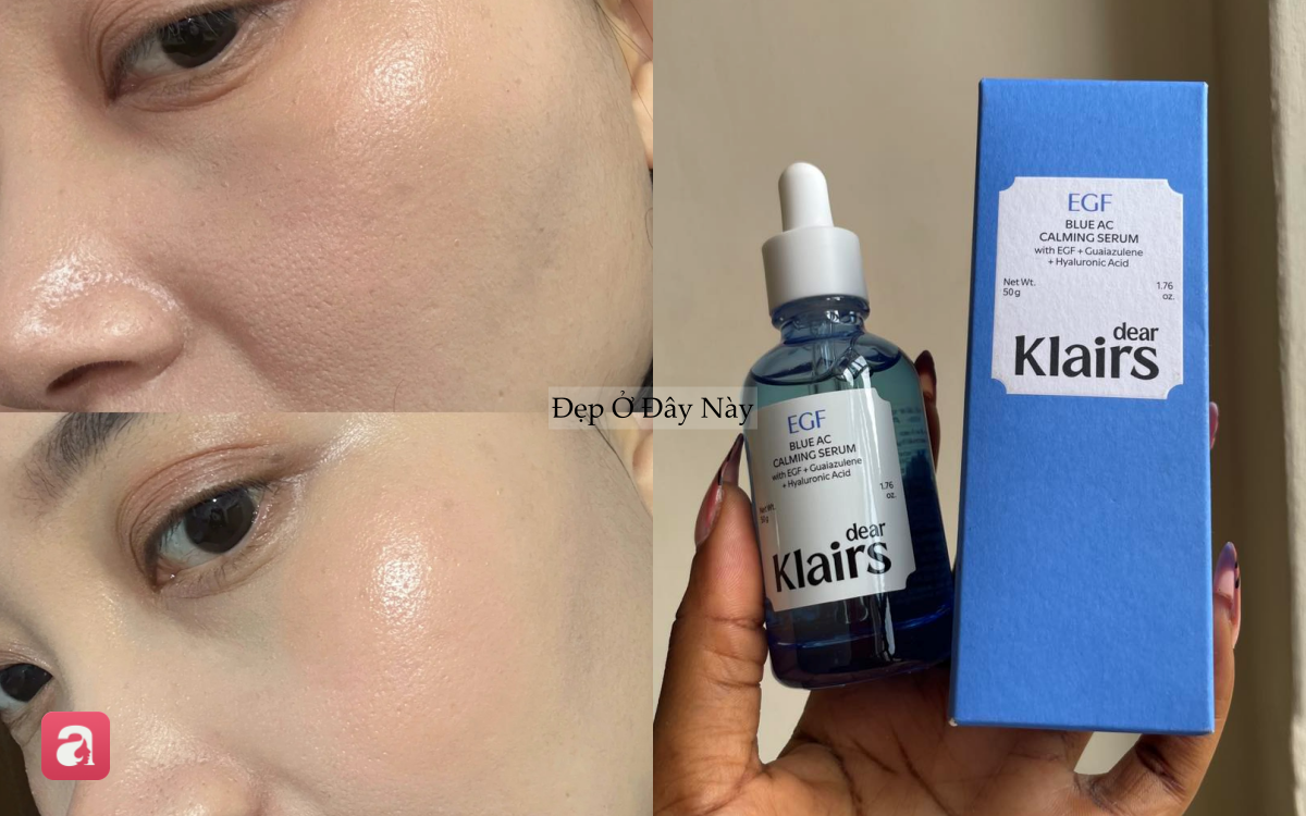 5 Th&agrave;nh phần chống l&atilde;o h&oacute;a thay thế retinol an to&agrave;n cho da nhạy cảm năm 20265 