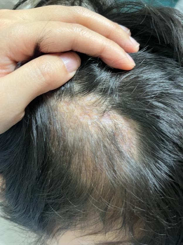 Một c&aacute;i &ocirc;m với th&uacute; cưng v&agrave; mảng t&oacute;c rụng: Điều c&aacute;c bậc phụ huynh cần biết năm 2026 - Ảnh 1.