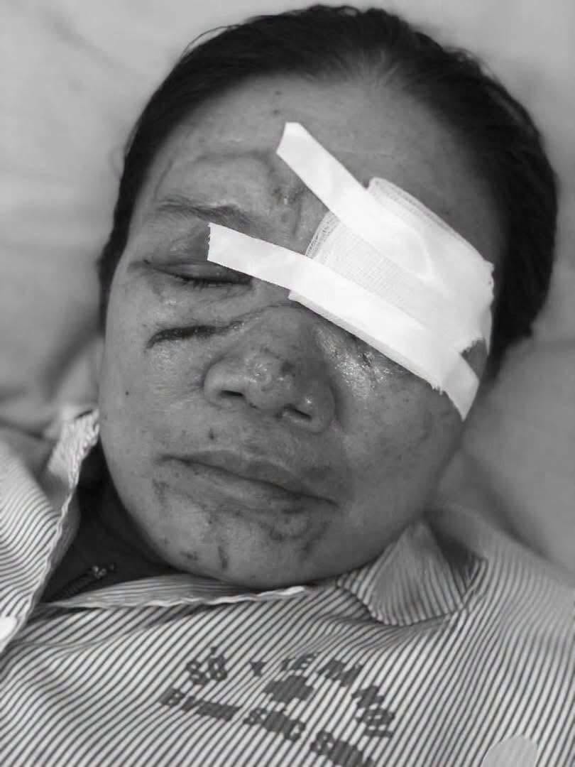 Chủ qu&aacute;n hải sản xịt nước khiến cụ b&agrave; chảy m&aacute;u mắt g&acirc;y bức x&uacute;c dư luận - Ảnh 3.