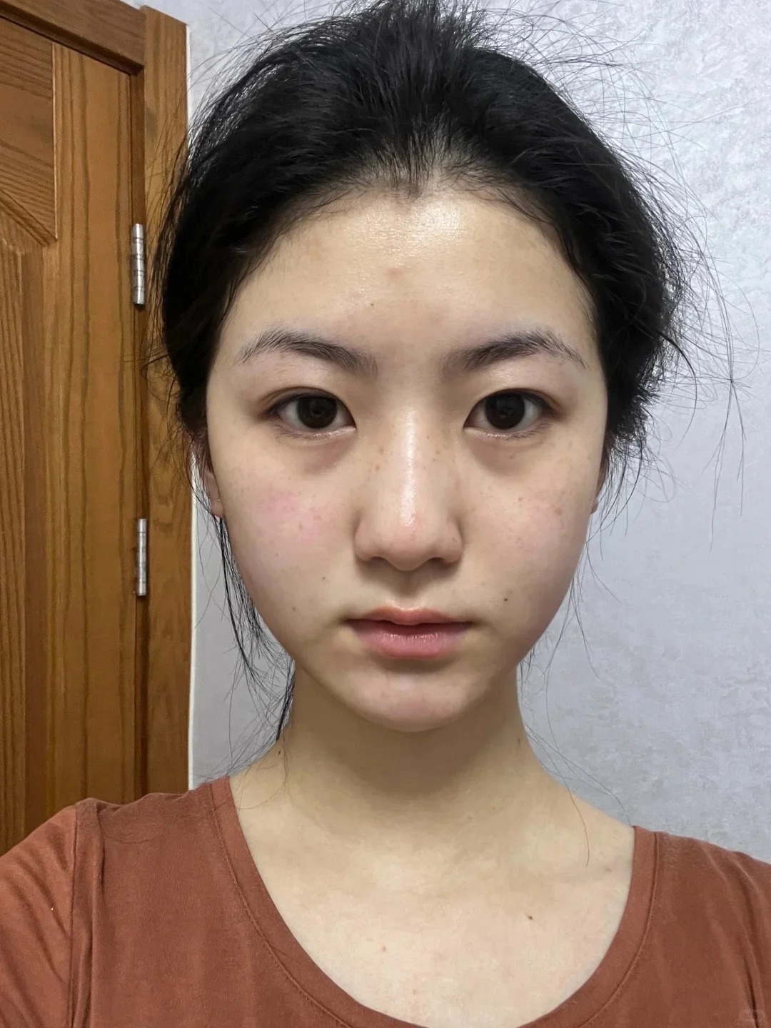 5 th&oacute;i quen khiến collagen 