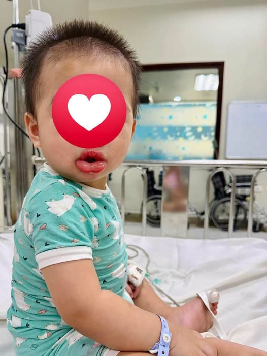 Mẹ bỉm chia sẻ chuyện chỉ vì 1 giây bất cẩn với thứ hầu như nhà nào cũng có này mà suýt phải trả cái giá đắt - Ảnh 1.