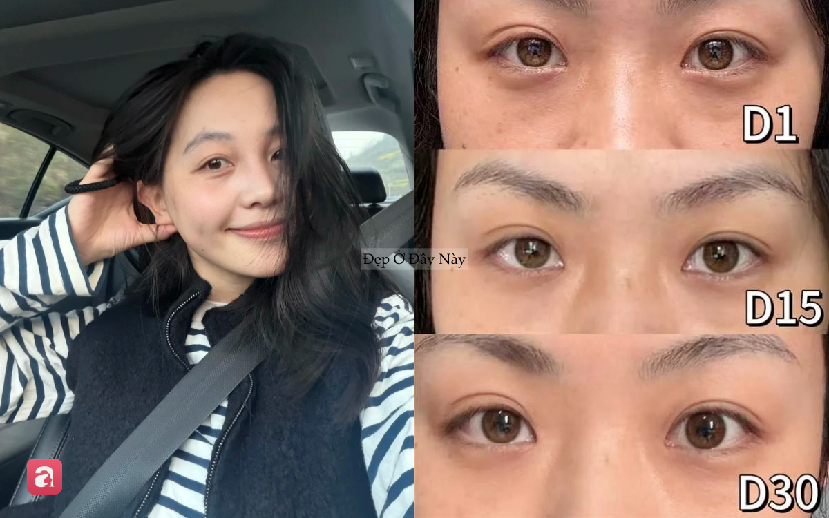B&aacute;c sĩ da liễu chấm 10/10 cho 6 loại kem dưỡng mắt n&agrave;y: Gi&aacute; b&igrave;nh d&acirc;n, hiệu quả tốt, ngừa nhăn từ b&ecirc;n trong - Ảnh 1.