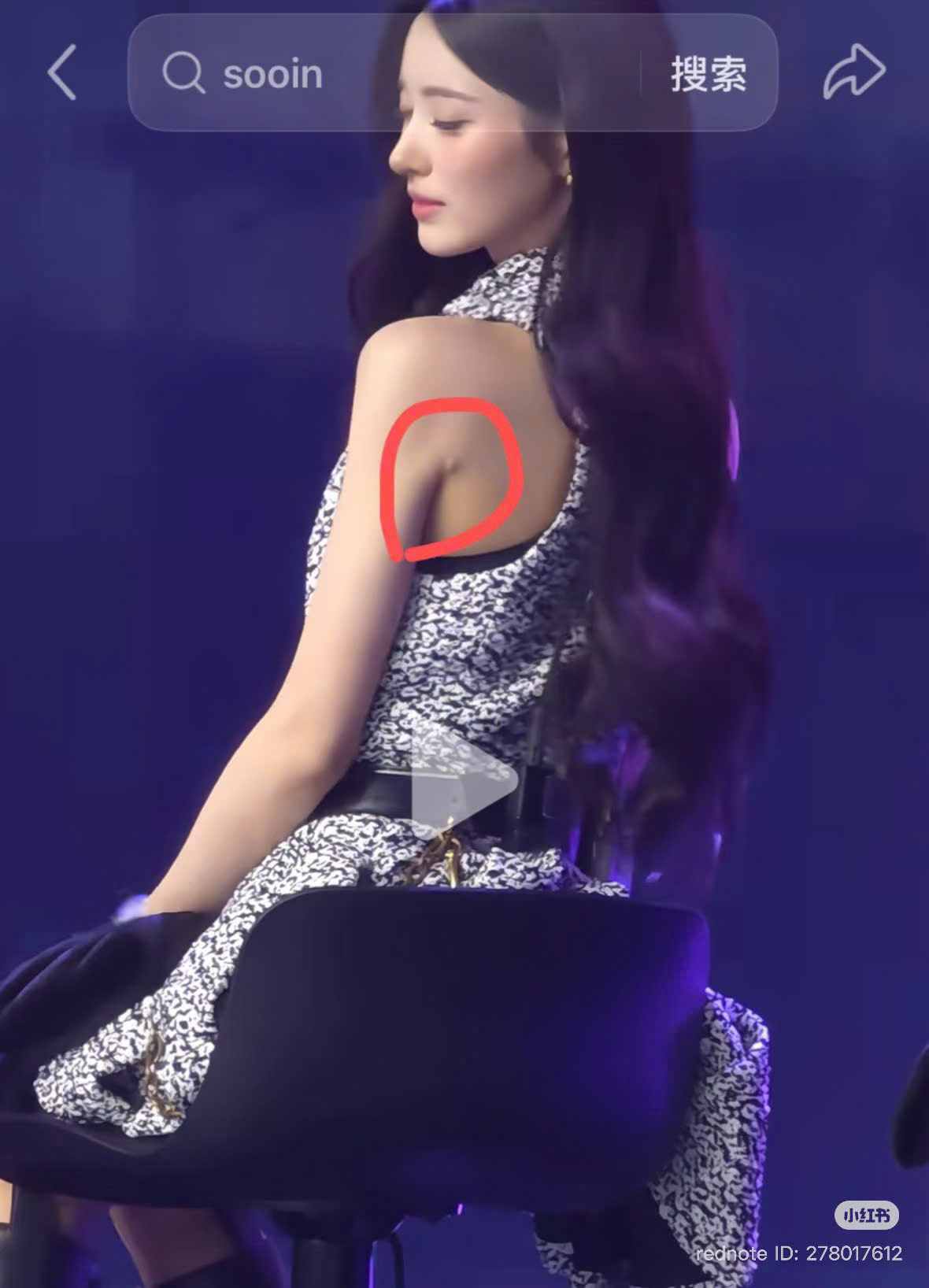 Đệ nhất mỹ nh&acirc;n showbiz thế hệ mới đẹp như tượng tạc vẫn kh&ocirc;ng h&agrave;i l&ograve;ng kh&aacute;n giả, lộ dấu vết h&uacute;t mỡ g&acirc;y sốc - Ảnh 4.