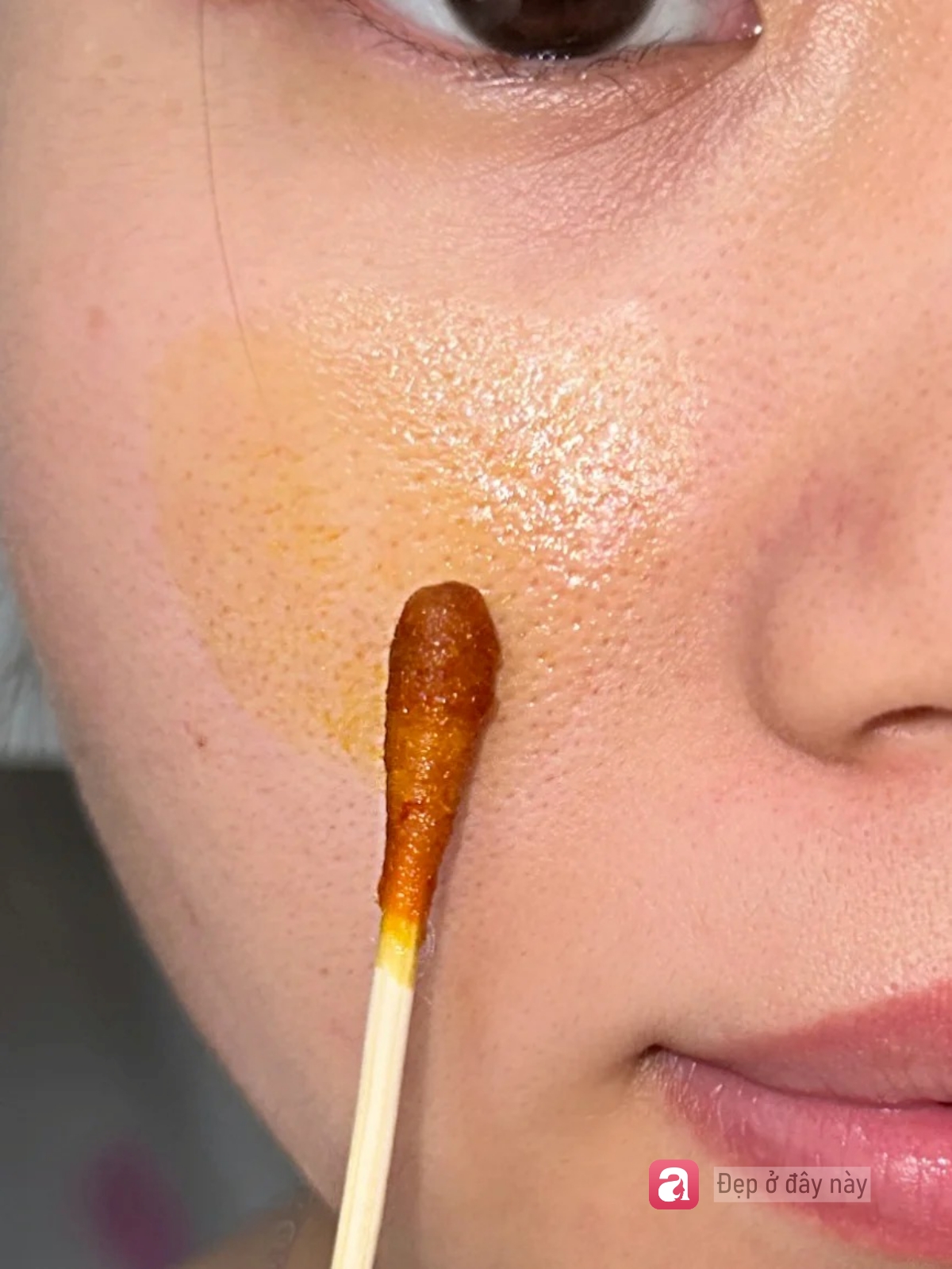 Kh&ocirc;ng serum đắt tiền, c&ocirc; g&aacute;i n&agrave;y chỉ d&ugrave;ng 3 m&oacute;n b&igrave;nh d&acirc;n để cải thiện bề mặt da- Ảnh 1.