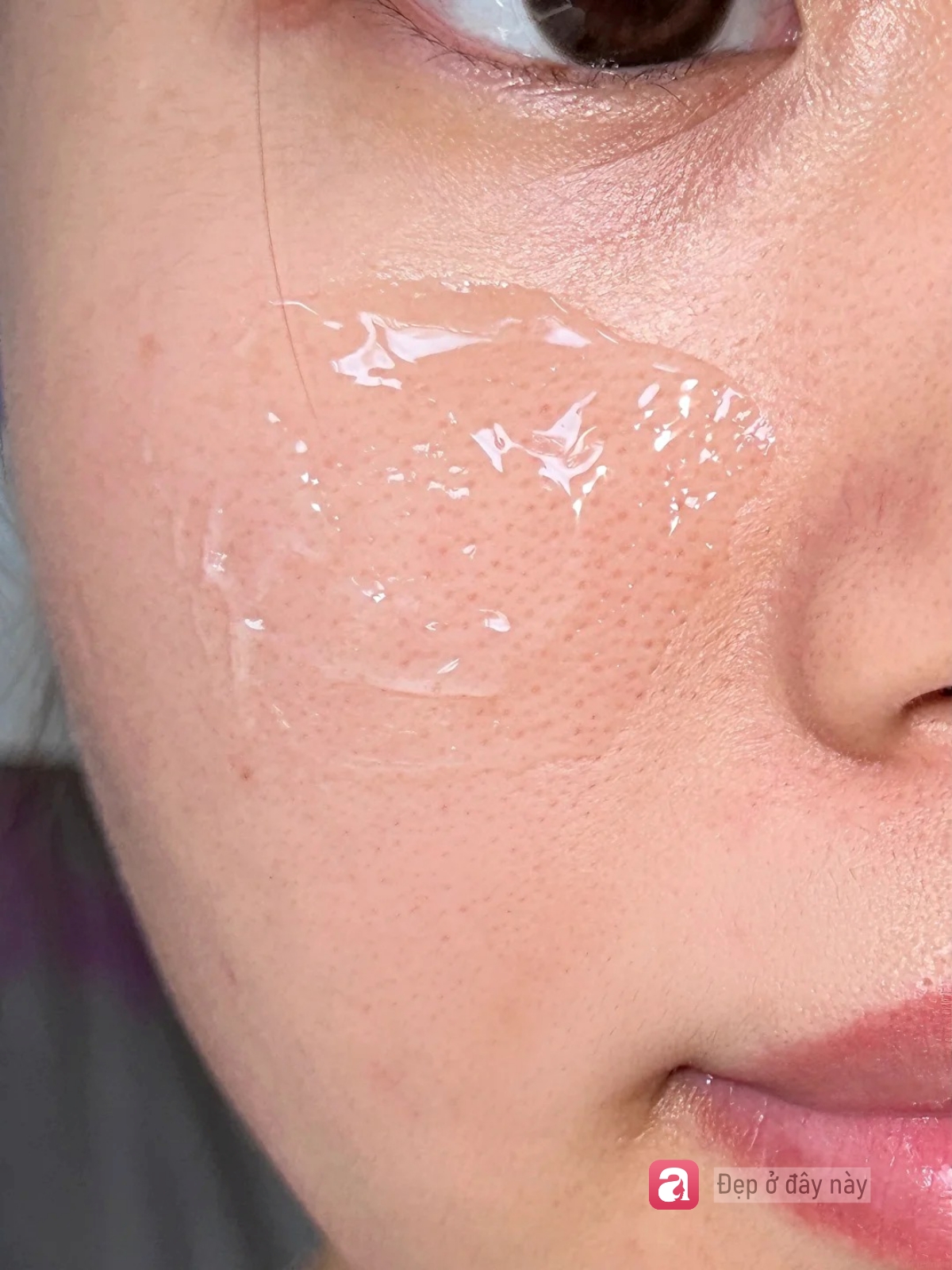 Kh&ocirc;ng serum đắt tiền, c&ocirc; g&aacute;i n&agrave;y chỉ d&ugrave;ng 3 m&oacute;n b&igrave;nh d&acirc;n để cải thiện bề mặt da- Ảnh 2.