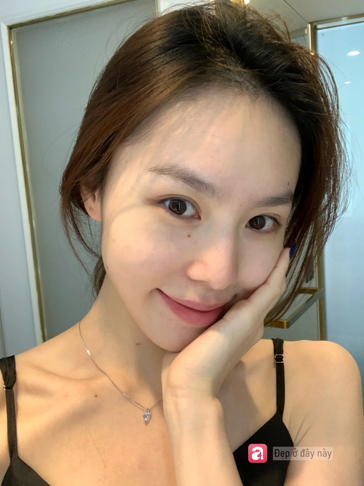 Kh&ocirc;ng serum đắt tiền, c&ocirc; g&aacute;i n&agrave;y chỉ d&ugrave;ng 3 m&oacute;n b&igrave;nh d&acirc;n để cải thiện bề mặt da- Ảnh 3.