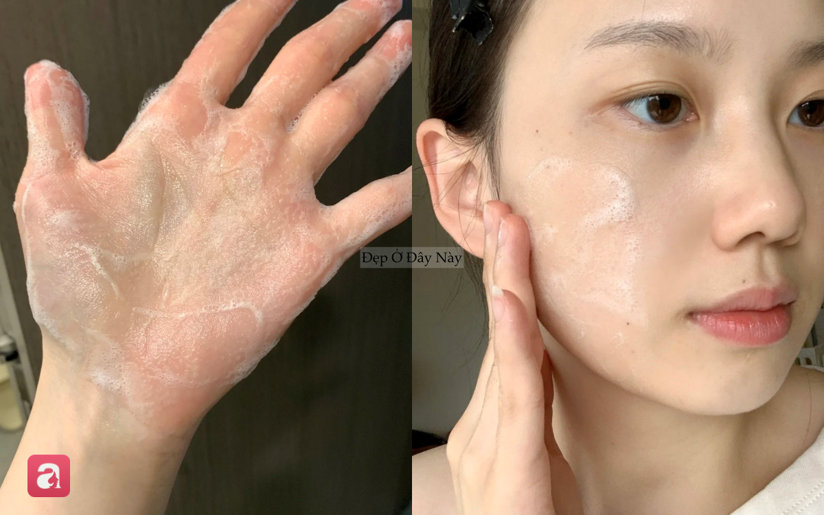 B&aacute;c sĩ da liễu chỉ ra c&aacute;ch rửa mặt gi&uacute;p da đẹp l&ecirc;n thấy r&otilde; chỉ sau 30 gi&acirc;y  - Ảnh 3.