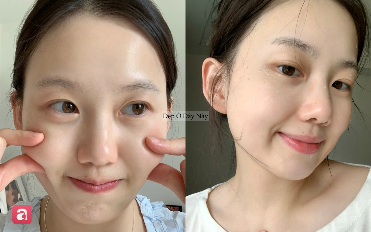 B&aacute;c sĩ da liễu chỉ ra c&aacute;ch rửa mặt gi&uacute;p da đẹp l&ecirc;n thấy r&otilde; chỉ sau 30 gi&acirc;y  - Ảnh 4.