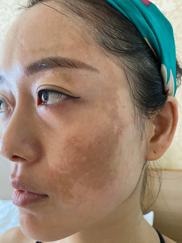 Phụ nữ ngo&agrave;i 40 đang truyền nhau kiểu dưỡng da mặt nh&igrave;n căng b&oacute;ng v&agrave; &iacute;t chảy xệ hơn- Ảnh 1.