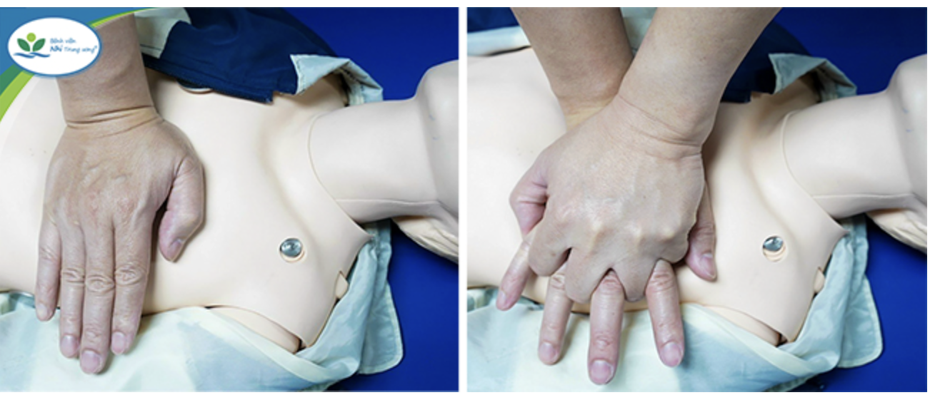 Sai lầm khi sơ cứu trẻ đuối nước khiến b&aacute;c sĩ đau l&ograve;ng - Ảnh 3.