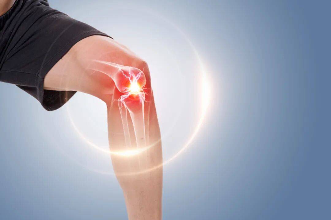 Đừng đợi đến khi kh&ocirc;ng thể ngồi xổm hay leo cầu thang mới lo giữ đầu gối: 5 dấu hiệu cảnh b&aacute;o khớp gối đang l&atilde;o h&oacute;a- Ảnh 1.