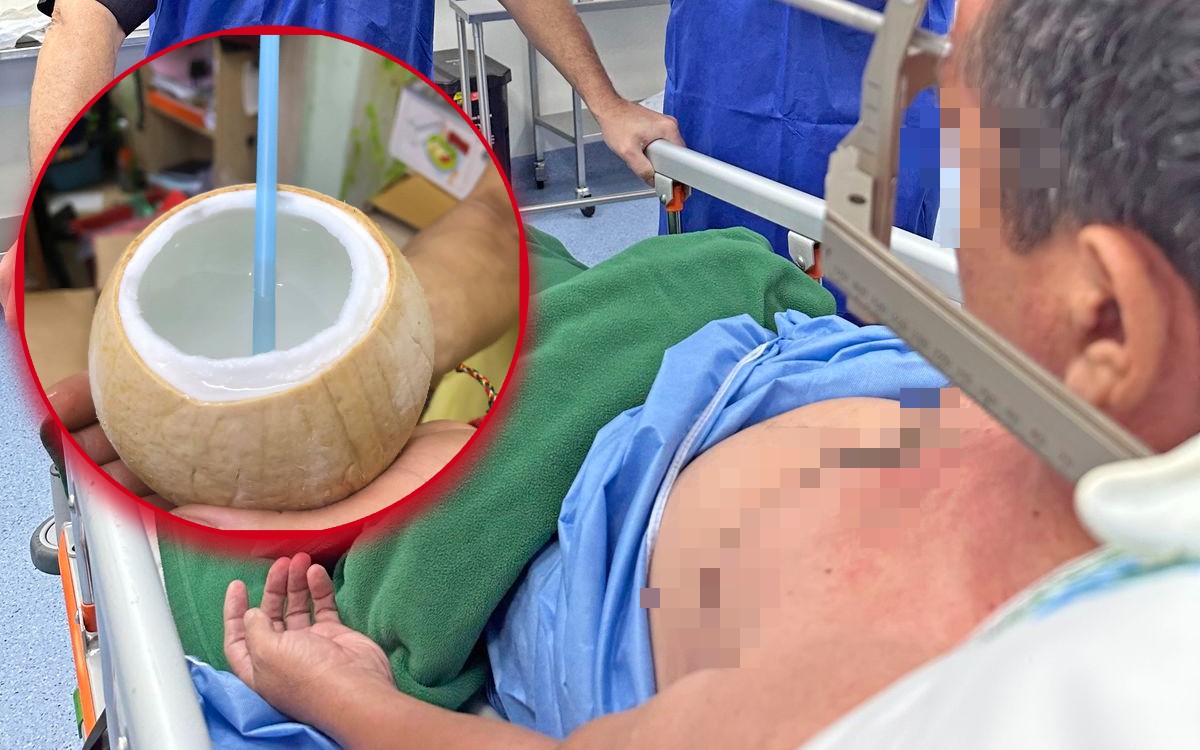 Lời khuy&ecirc;n cho những người hay uống nước dừa - Ảnh 2.