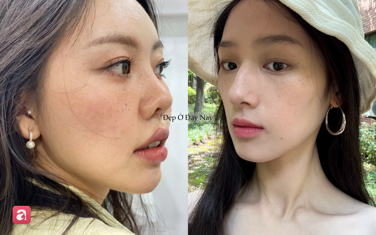 5 sai lầm tưởng nhỏ nhưng lại khiến da dễ bị nám: Nhiều chị em vẫn mắc phải mỗi ngày - Ảnh 1.