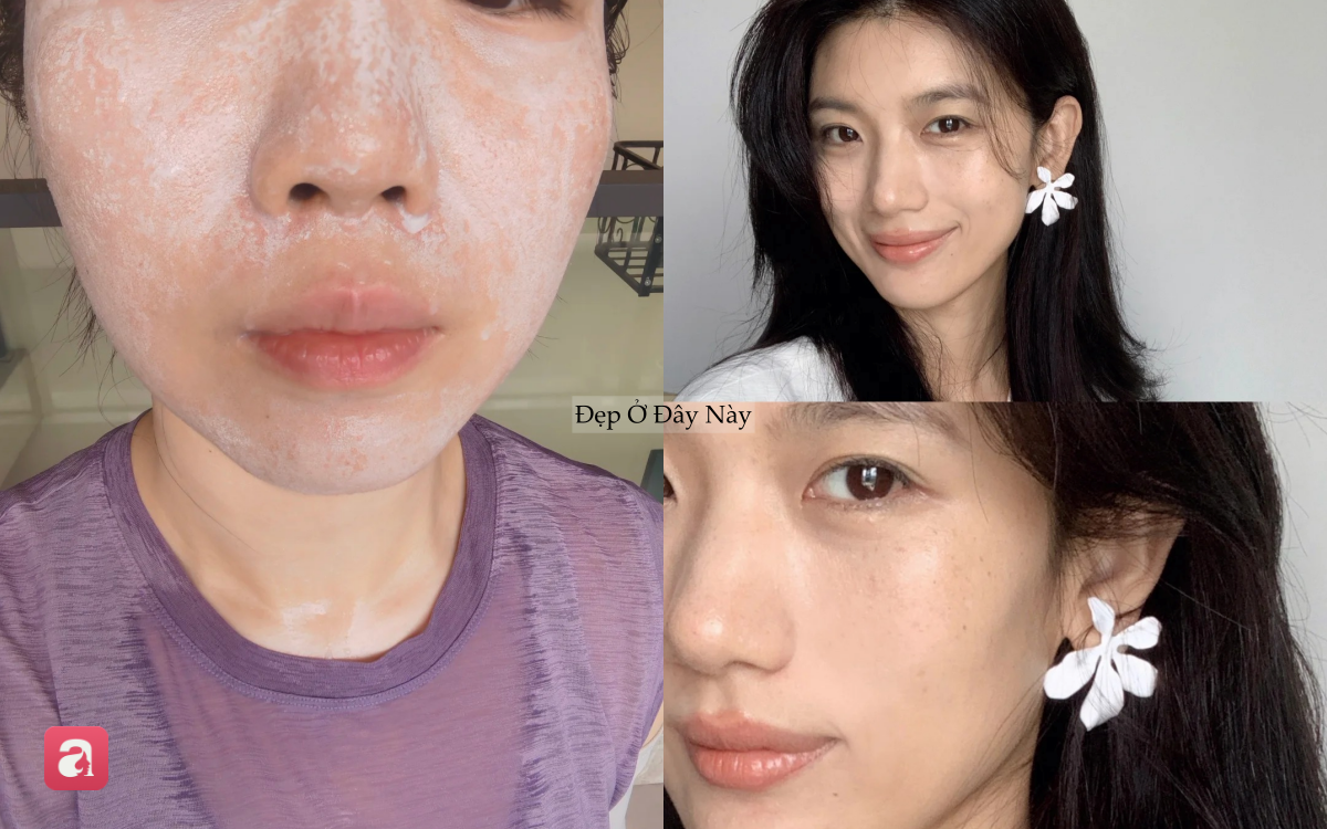 5 sai lầm tưởng nhỏ nhưng lại khiến da dễ bị nám: Nhiều chị em vẫn mắc phải mỗi ngày - Ảnh 2.