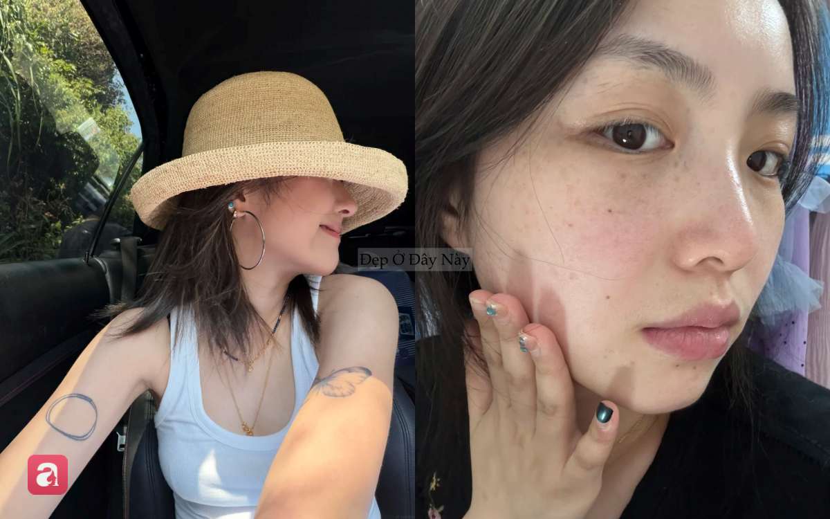 5 sai lầm tưởng nhỏ nhưng lại khiến da dễ bị nám: Nhiều chị em vẫn mắc phải mỗi ngày - Ảnh 3.