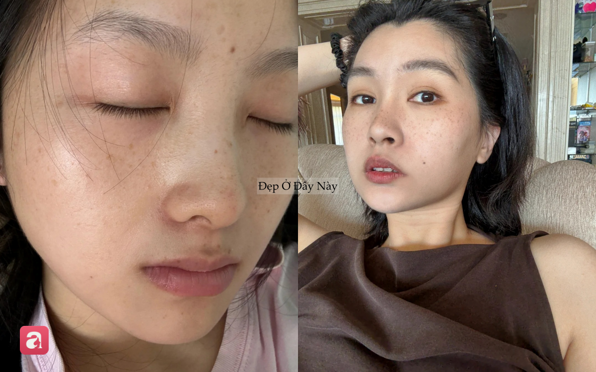 5 sai lầm tưởng nhỏ nhưng lại khiến da dễ bị nám: Nhiều chị em vẫn mắc phải mỗi ngày - Ảnh 4.