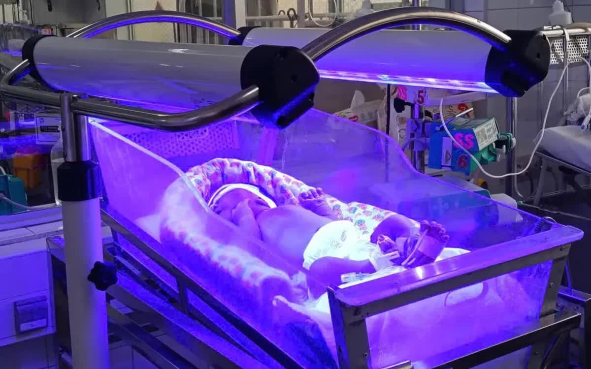 Đừng chủ quan khi trẻ sơ sinh bị v&agrave;ng da , cần theo d&otilde;i s&aacute;t sao Ngay từ đầu - Ảnh 1.