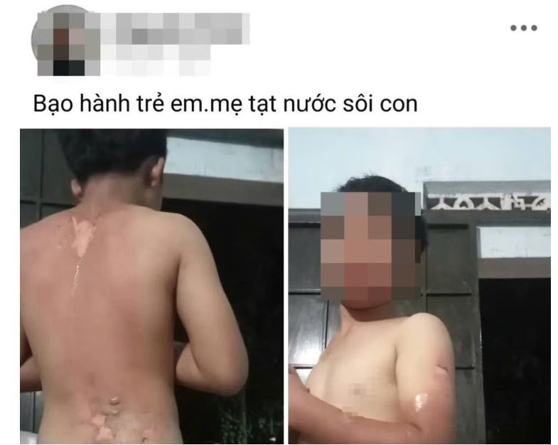 Mẹ ruột tạt nước s&ocirc;i g&acirc;y bỏng cho con trai ở Đắk Lắk: Vụ bạo h&agrave;nh g&acirc;y chấn động - Ảnh 1.