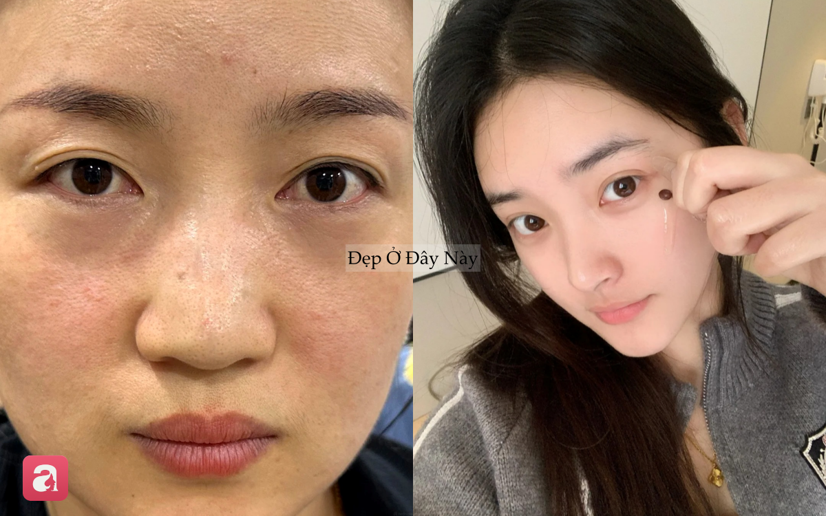 Vì sao càng dưỡng nhiều da càng xấu? 5 sai lầm khiến skincare mãi không hiệu quả - Ảnh 1.