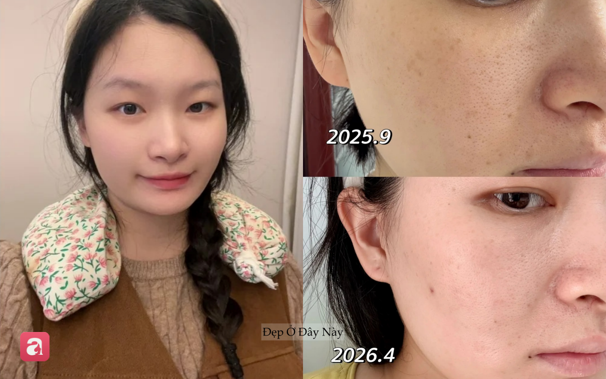 Từng khổ sở vì nám sau sinh, nàng blogger lấy lại làn da sáng khỏe nhờ routine đơn giản - Ảnh 1.