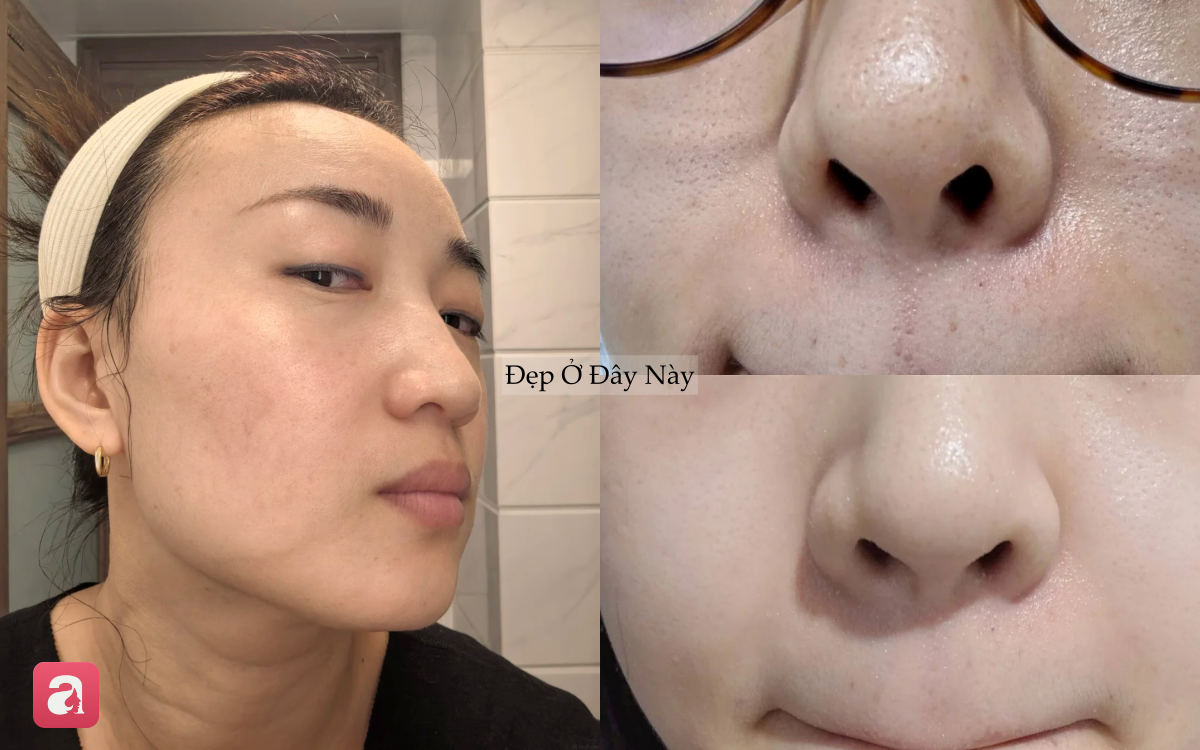 Vì sao càng dưỡng nhiều da càng xấu? 5 sai lầm khiến skincare mãi không hiệu quả - Ảnh 2.