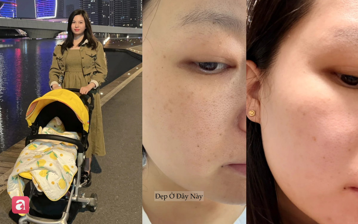 Từng khổ sở vì nám sau sinh, nàng blogger lấy lại làn da sáng khỏe nhờ routine đơn giản - Ảnh 2.