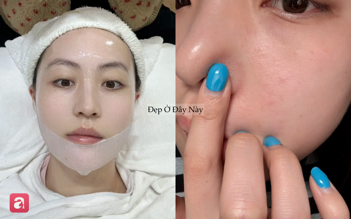 Vì sao càng dưỡng nhiều da càng xấu? 5 sai lầm khiến skincare mãi không hiệu quả - Ảnh 3.