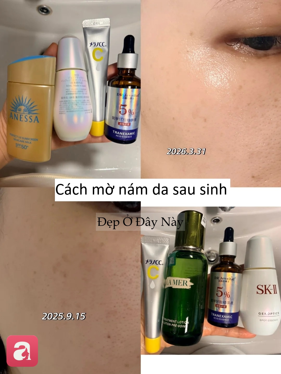 Từng khổ sở vì nám sau sinh, nàng blogger lấy lại làn da sáng khỏe nhờ routine đơn giản - Ảnh 3.