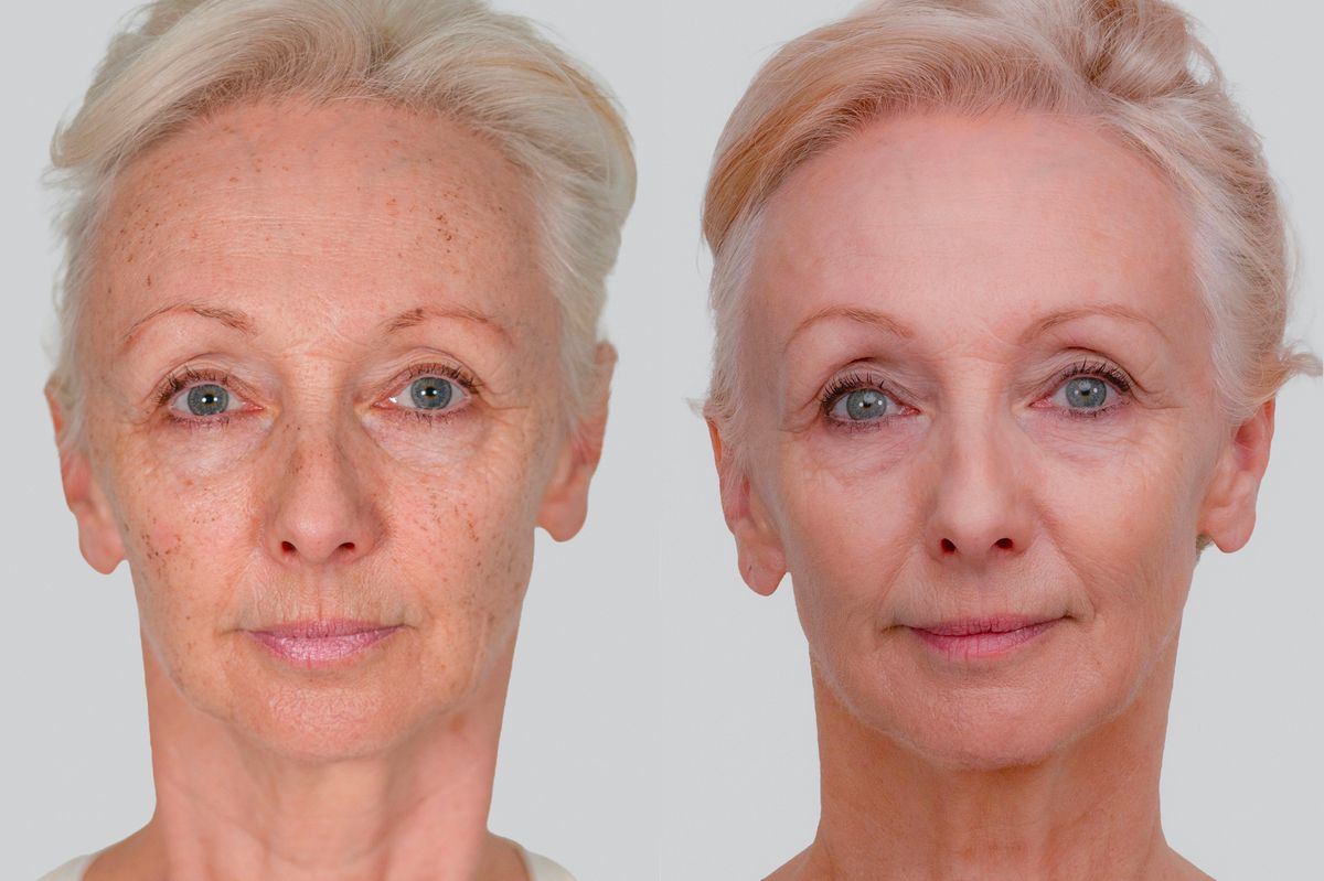 Không tiêm Botox, không phẫu thuật, nữ nghệ sĩ 67 tuổi khiến nhiều người ngỡ chỉ ngoài 40 nhờ một công nghệ trẻ hóa không cần dao kéo - Ảnh 1.