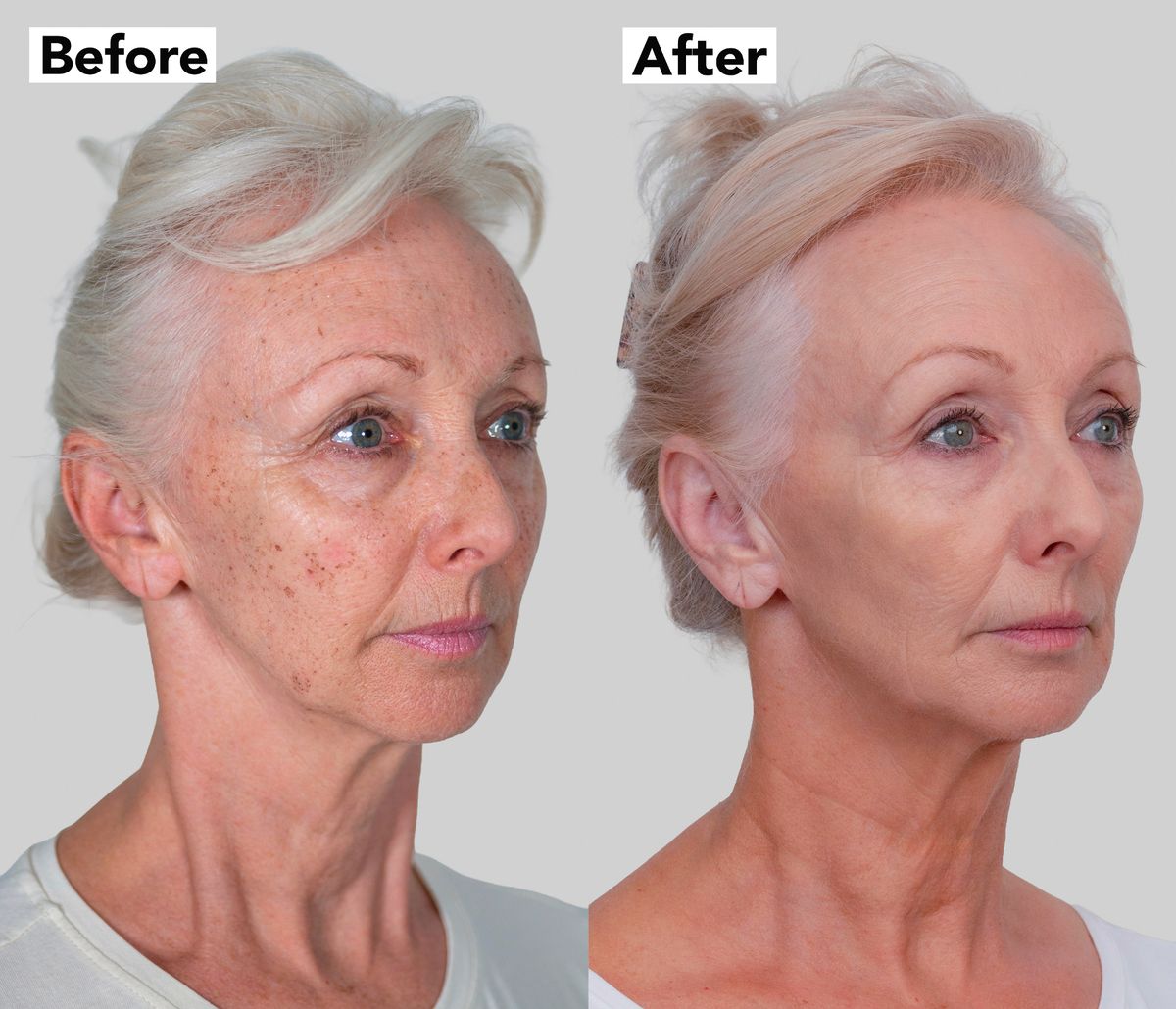 Không tiêm Botox, không phẫu thuật, nữ nghệ sĩ 67 tuổi khiến nhiều người ngỡ chỉ ngoài 40 nhờ một công nghệ trẻ hóa không cần dao kéo - Ảnh 2.