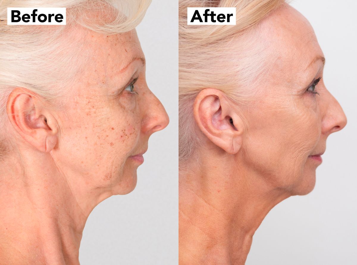 Không tiêm Botox, không phẫu thuật, nữ nghệ sĩ 67 tuổi khiến nhiều người ngỡ chỉ ngoài 40 nhờ một công nghệ trẻ hóa không cần dao kéo - Ảnh 4.
