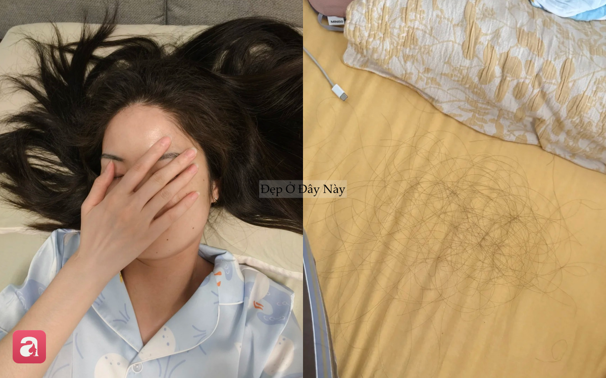 S&aacute;ng n&agrave;o cũng thấy t&oacute;c rụng đầy gối? C&oacute; thể bạn đang mắc 5 sai lầm n&agrave;y trước khi ngủ - Ảnh 1.