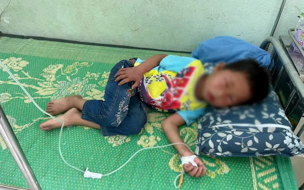 Hai trẻ bị sốc phản vệ nguy kịch sau khi bị ong đốt tại Th&aacute;i Nguy&ecirc;n - Ảnh 1.