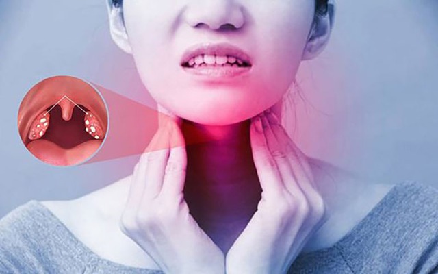 Bé trai 14 tuổi chiến thắng ung thư vòm mũi họng giai đoạn tiến triển: Bác sĩ cảnh báo những dấu hiệu cha mẹ rất dễ bỏ qua - Ảnh 3.