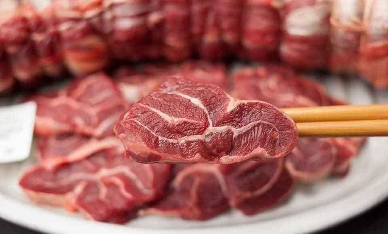 Người đ&agrave;n &ocirc;ng sốt nhẹ 2 th&aacute;ng, b&aacute;c sĩ ph&aacute;t hiện đốt sống cổ bị 