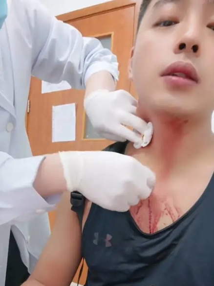 Một người đ&agrave;n &ocirc;ng su&yacute;t chết v&igrave; bị muỗi đốt sau khi tập thể dục! - Ảnh 1.