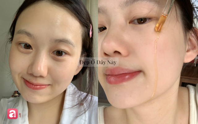 Ki&ecirc;n tr&igrave; &ldquo;s&aacute;ng vitamin C, tối retinol&rdquo; suốt nửa năm, l&agrave;n da mộc của t&ocirc;i thay đổi r&otilde; rệt - Ảnh 1.
