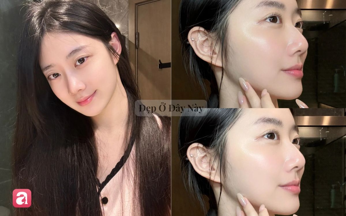 5 lọ toner acid được ví như