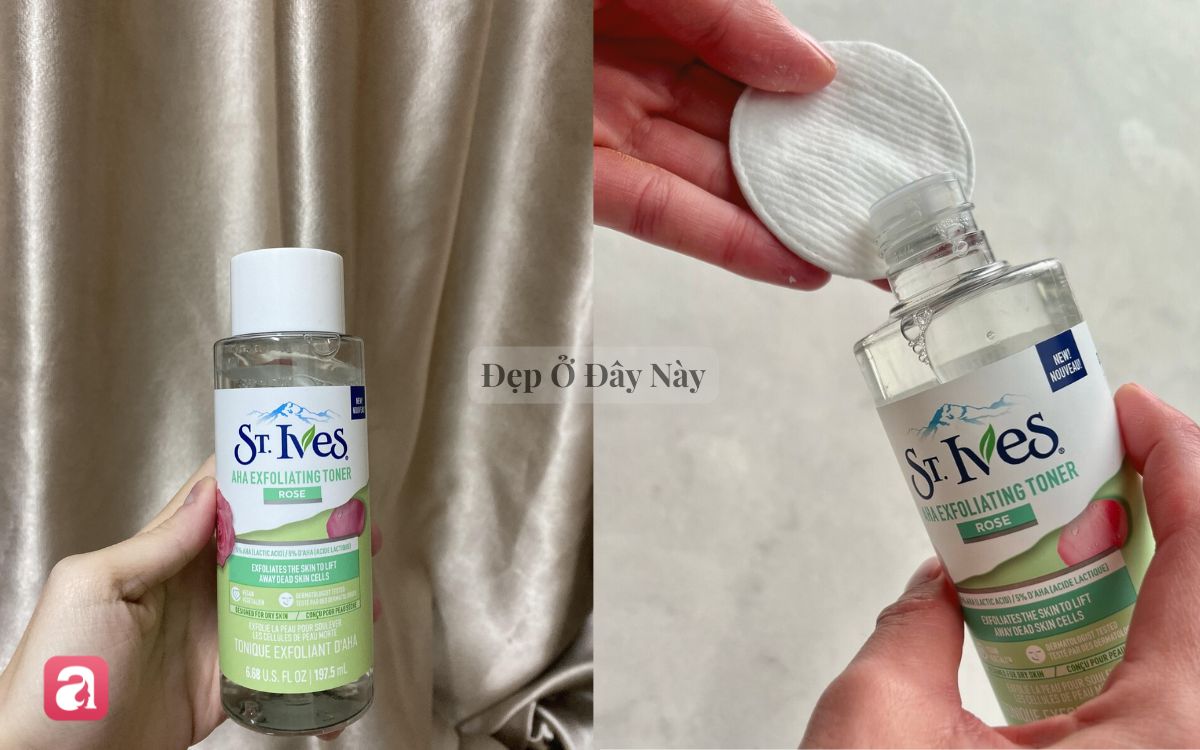 5 lọ toner acid được ví như