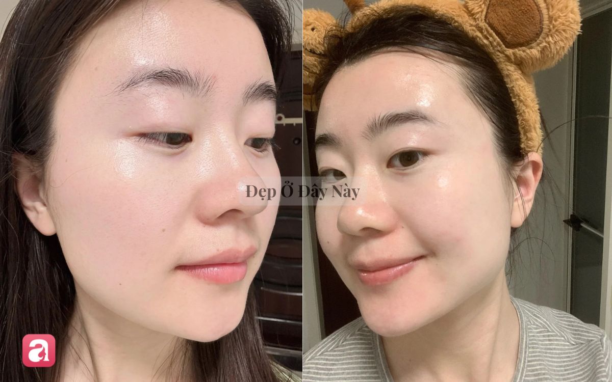 V&igrave; sao dưỡng da qu&aacute; nhiều lại c&oacute; thể khiến l&agrave;n da ng&agrave;y c&agrave;ng xấu đi? - Ảnh 2.