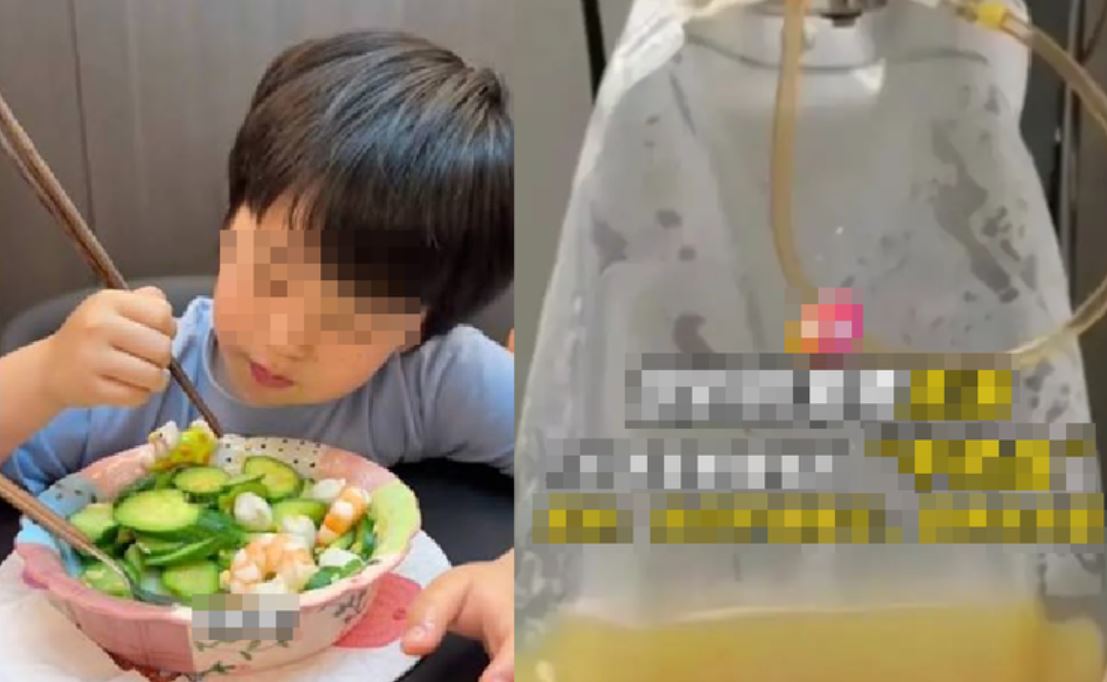 B&eacute; trai 5 tuổi mắc bệnh v&igrave; ăn canh hầm thường xuy&ecirc;n , cần lưu &yacute; dinh dưỡng - Ảnh 1.