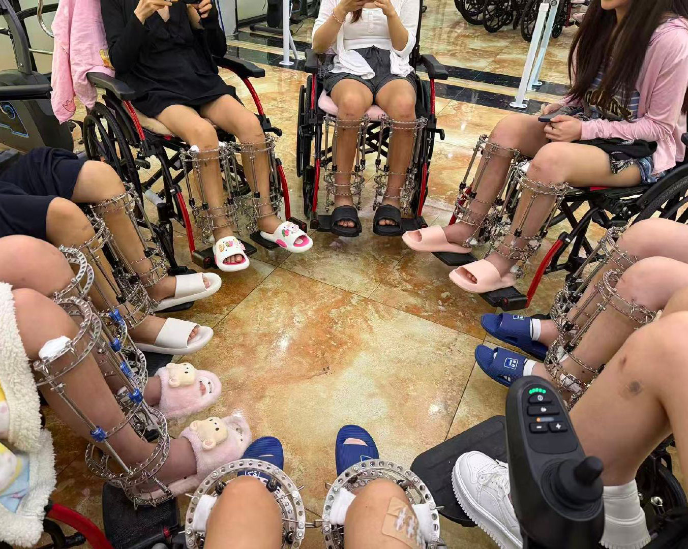 Điều tra chợ đen phẫu thuật k&eacute;o d&agrave;i ch&acirc;n tại Trung Quốc v&agrave; những hệ lụy nhức nhối - Ảnh 3.