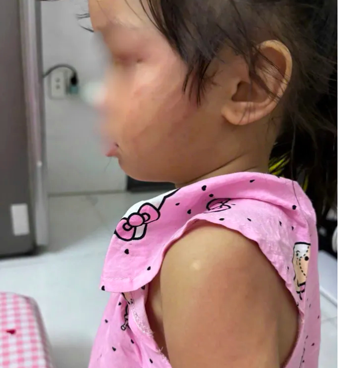 Cha dượng đ&aacute;nh b&eacute; g&aacute;i 3 tuổi g&acirc;y phẫn nộ , C&ocirc;ng an v&agrave;o cuộc điều tra - Ảnh 1.