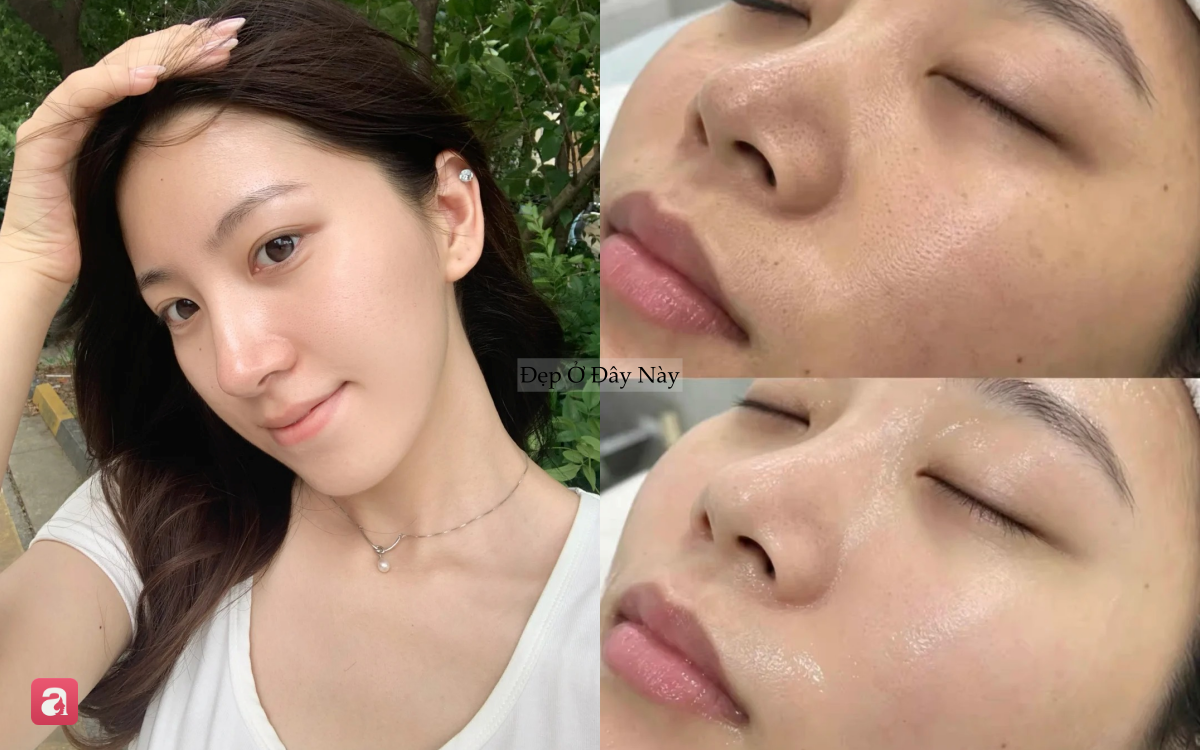 Bác sĩ da liễu chọn ra 7 loại
