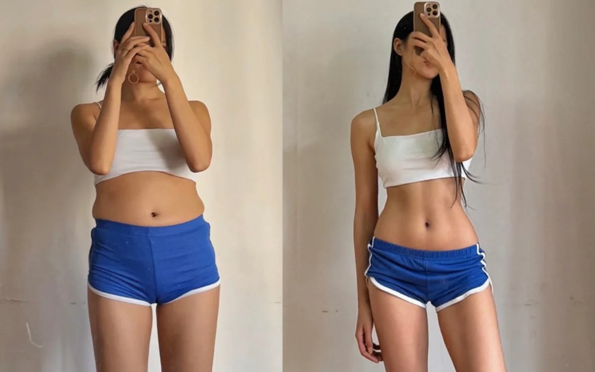 10 giờ vi phẫu cứu 3 ng&oacute;n tay gần đứt l&igrave;a cho nam thanh ni&ecirc;n - Ảnh 3.
