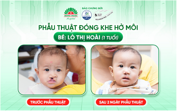 Vượt gần 300km từ Sơn La xuống Hà Nội, ba mẹ đi tìm nụ cười trọn vẹn cho con - Ảnh 3. Vượt gần 300km từ Sơn La xuống Hà Nội, ba mẹ đi tìm nụ cười trọn vẹn cho con - Ảnh 3.
