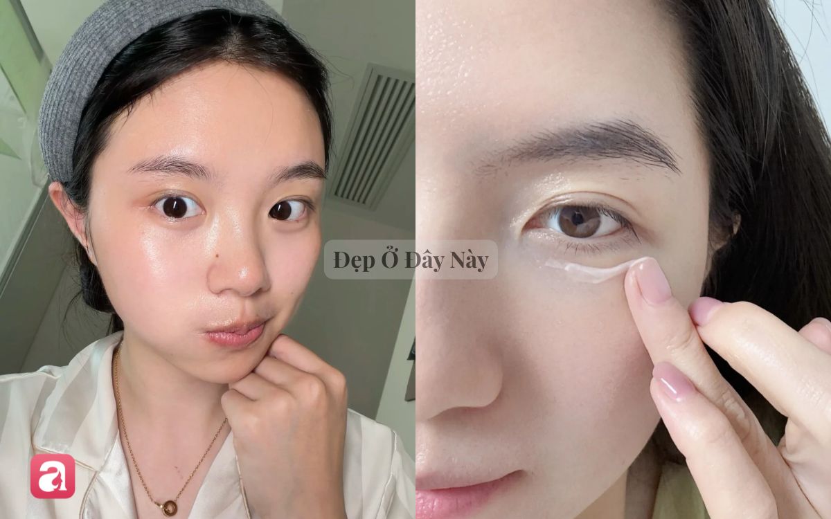 B&aacute;c sĩ da liễu chọn ra 6 tu&yacute;p kem mắt b&igrave;nh d&acirc;n gi&uacute;p cải thiện quầng th&acirc;m, nếp nhăn - Ảnh 1.