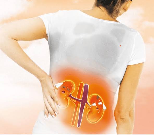 Tưởng đau lưng do ngồi nhiều, hóa ra thận cũng có thể đang “lên tiếng”: 3 điểm giúp phân biệt đau thận hay đau lưng - Ảnh 2.