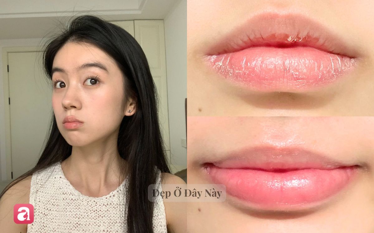 Mỗi tối b&ocirc;i thứ n&agrave;y, m&ocirc;i sẽ căng mọng hồng h&agrave;o chẳng cần t&ocirc; son - Ảnh 1.
